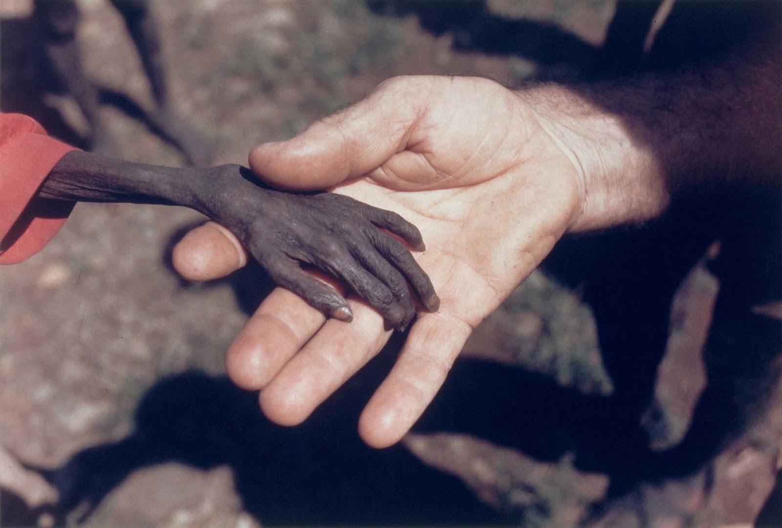 Une affamée garçon et une missionnaire en Ouganda, 1980